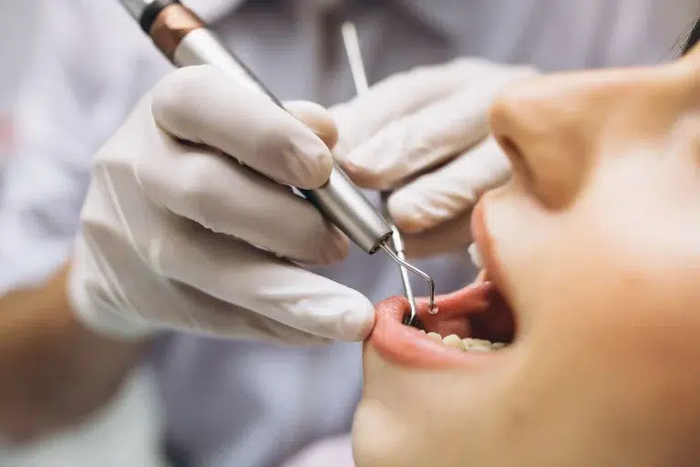 Endodoncia ¿Qué es y cuándo es necesaria?