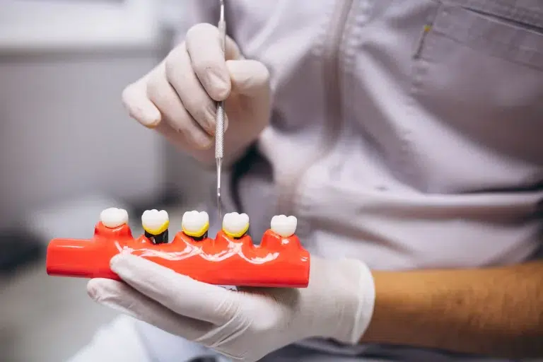 gingivitis-encias-periodoncia-que-es-clinica-dental-en-mairena-del-aljarafe-pisa-clinica-dental