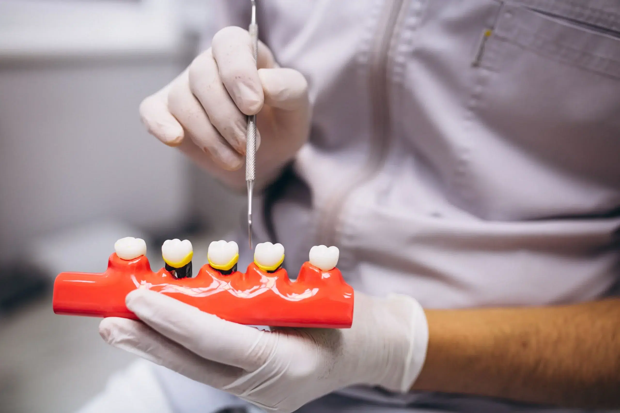 gingivitis-encias-periodoncia-que-es-clinica-dental-en-mairena-del-aljarafe-pisa-clinica-dental