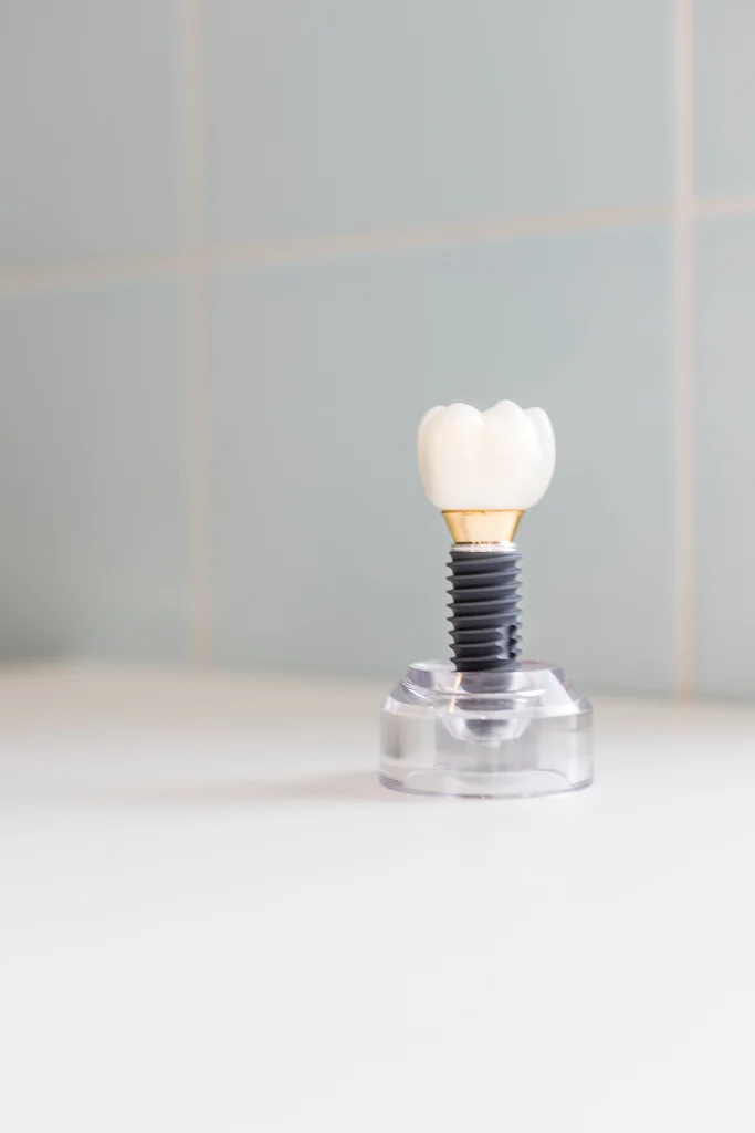 implantes dentales en mairena del aljarafe clinica dental pisa