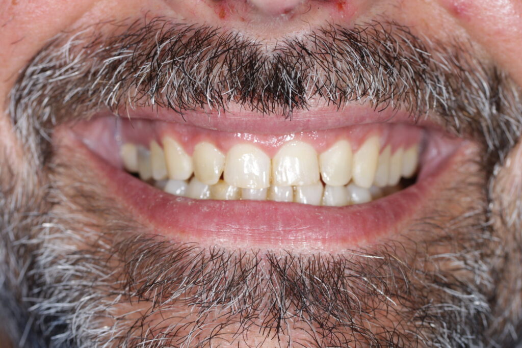 Pisa clinica dental en mairena del aljarafe