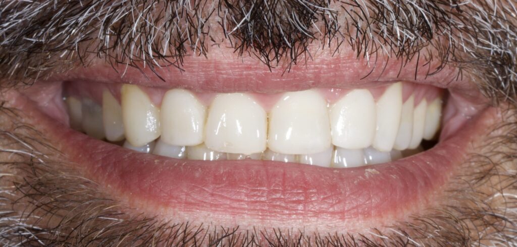 Pisa clinica dental en mairena del aljarafe