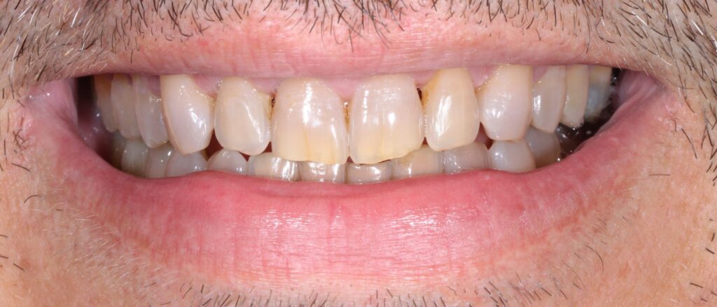 Pisa clinica dental en mairena del aljarafe