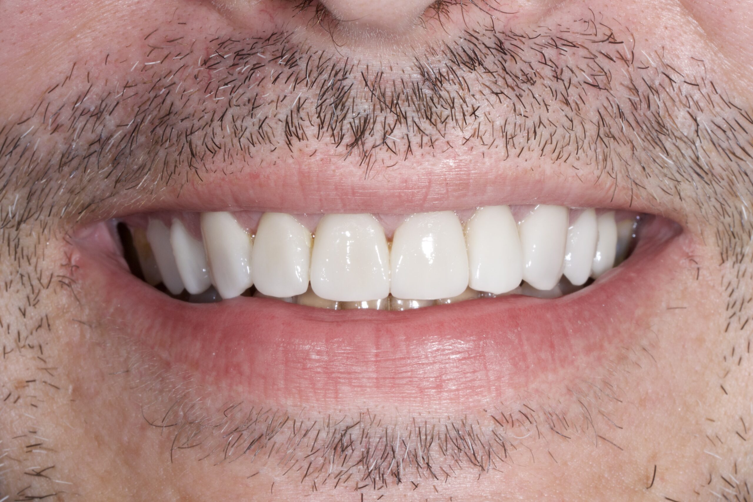 Pisa clinica dental en mairena del aljarafe