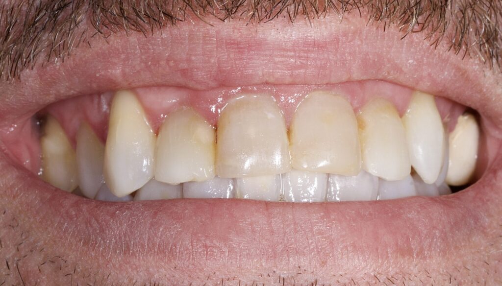 Pisa clinica dental en mairena del aljarafe