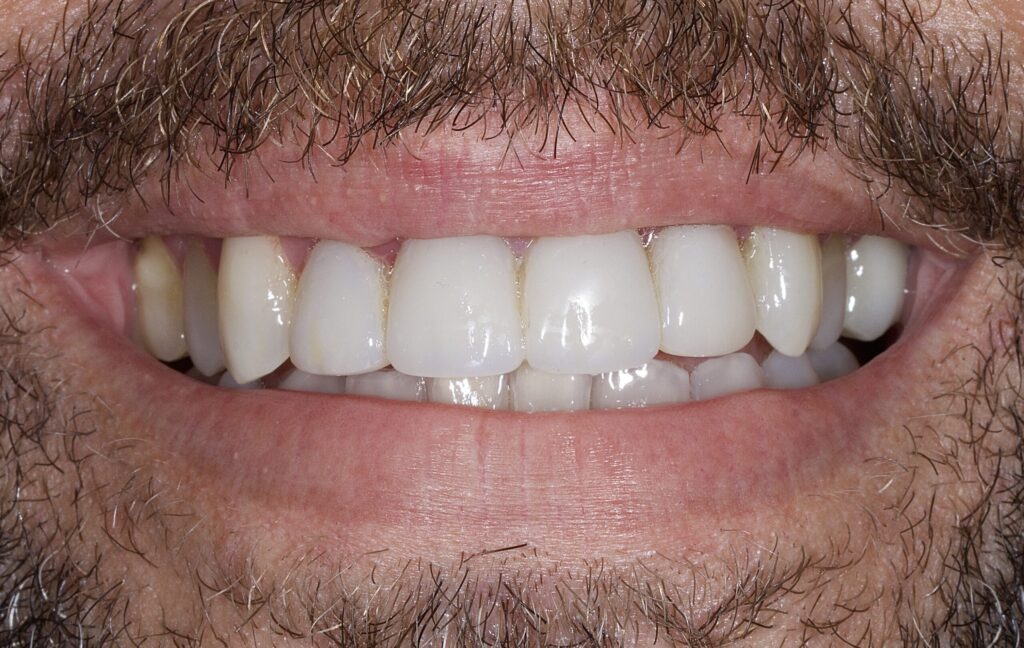 Pisa clinica dental en mairena del aljarafe