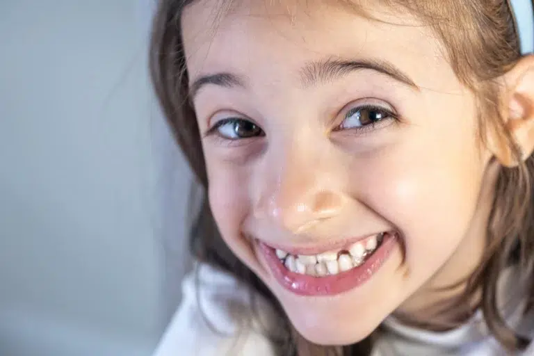 Ortodoncia infantil - A qué edad se recomienda clinica dental en mairena del aljarafe
