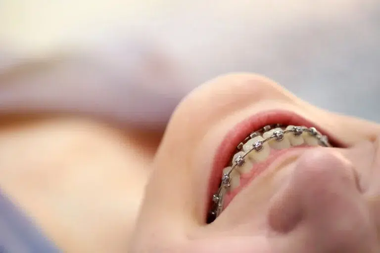 Causas Del Dolor Mandibular Y Su Relación Con La Ortodoncia en mairena del aljarafe pisa clinica dental