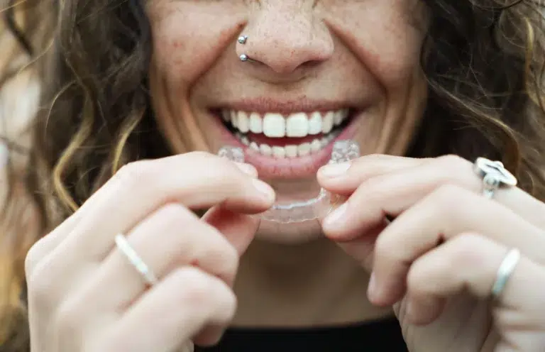 Cuánto Tiempo Hay Que Llevar Alineadores En Ortodoncia Invisible en mairena del aljarafe pisa clinica dental