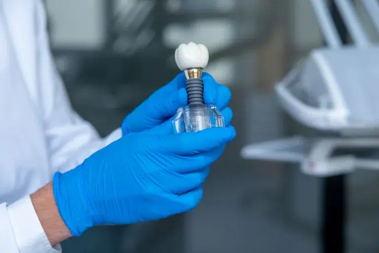 Cuánto Dura Un Tratamiento De Implantes Dentales en mairena del aljarafe pisa clinica dental