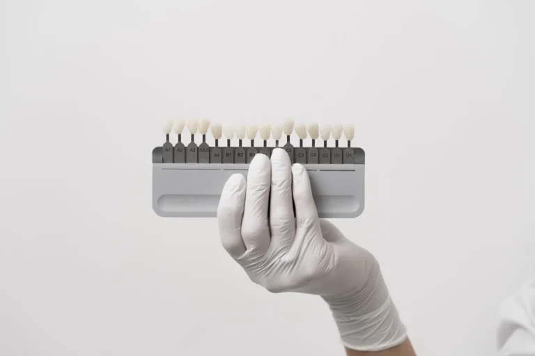Combinar blanqueamiento y carillas en mairena del aljarafe pisa clinica dental